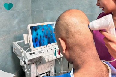 Hair transplant Follicle