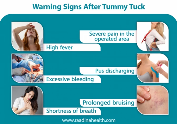 Warning Signs After Tummy Tuck
