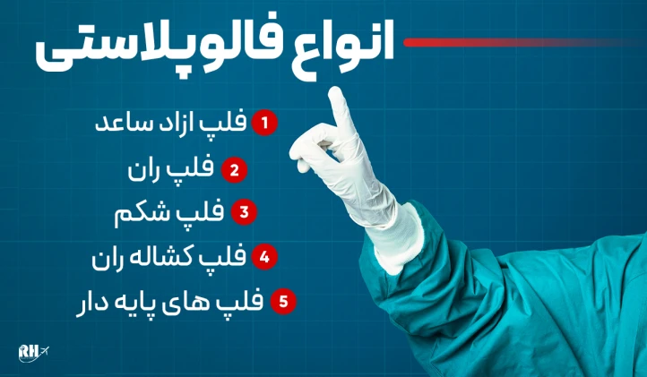 انواع فالوپلاستی