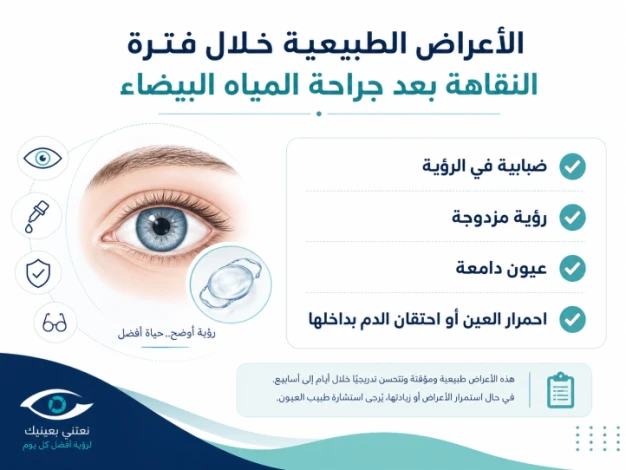 فترة النقاهة بعد عملية المياه البيضاء