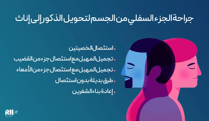 عمليات التحول من ذكر لأنثى (MTF):