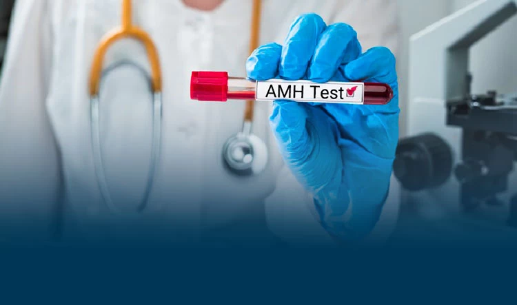 آزمایش AMH