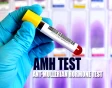 آزمایش AMH