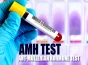 آزمایش AMH
