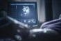 ملاحظات أساسیة بعد عملیة الإخصاب خارج الرحم (IVF)
