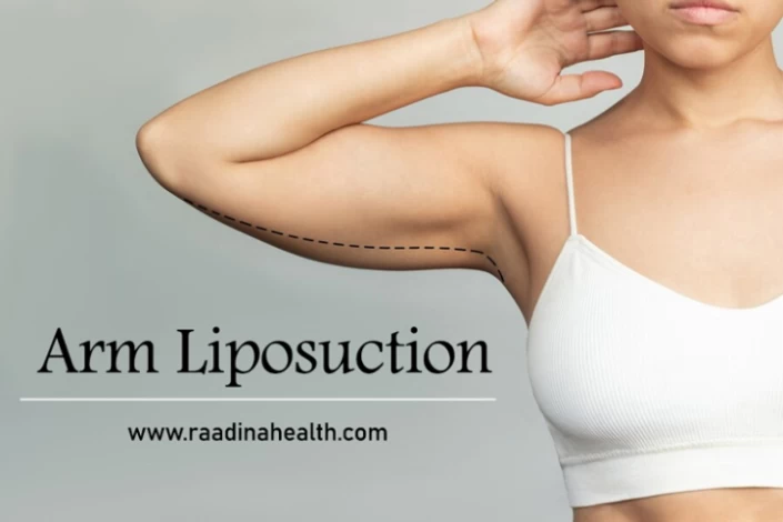 Arm Care - Liposuction Under Arms - Cosmos Aesthetics