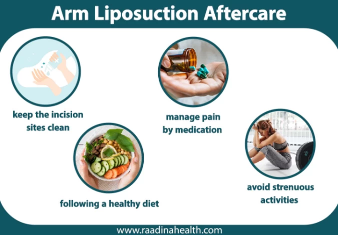 Liposuction Aftercare: What to Do During Lipo Recovery? - Raadina