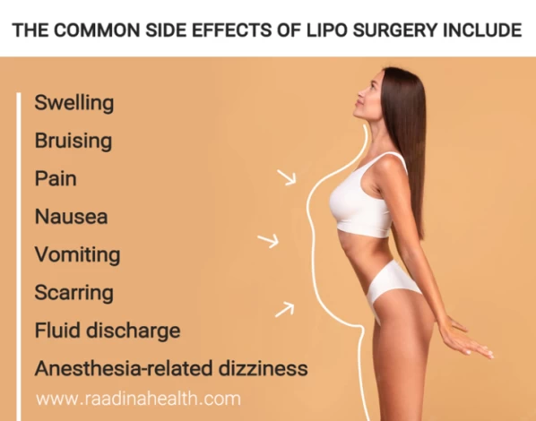 6 Signs of Bad Liposuction and How to Fix Them