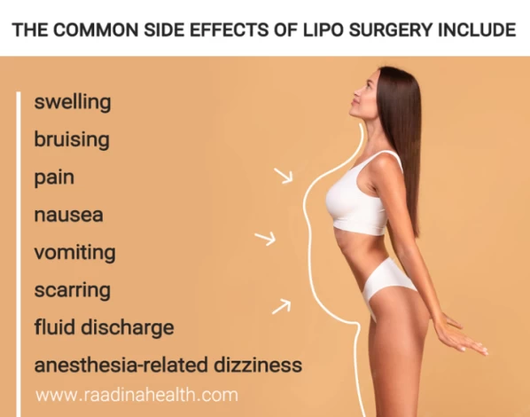 Possible Side Effects of Liposuction The common side effects of lipo surgery