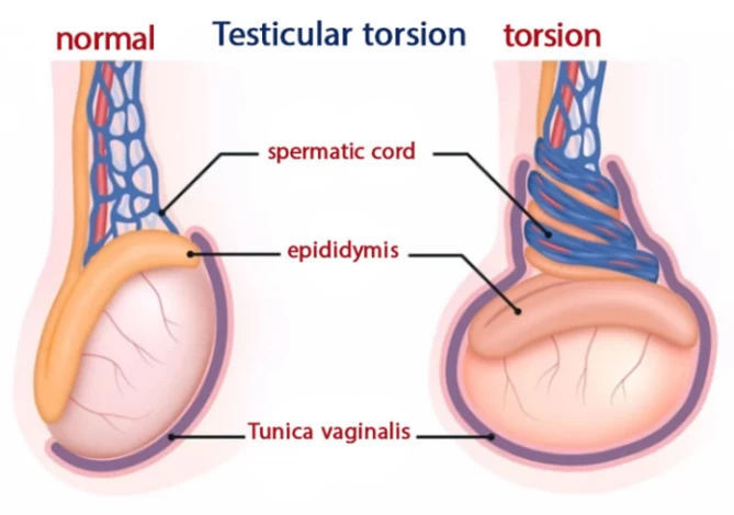 Testicle temperature on sale