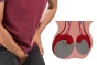 Testicular Atrophy