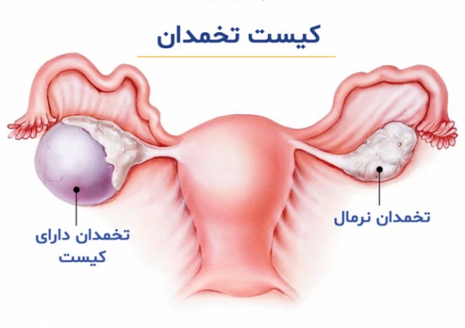 فواید استفاده از ماما