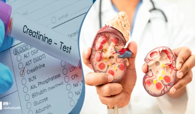 کراتین بعد از پیوند کلیه