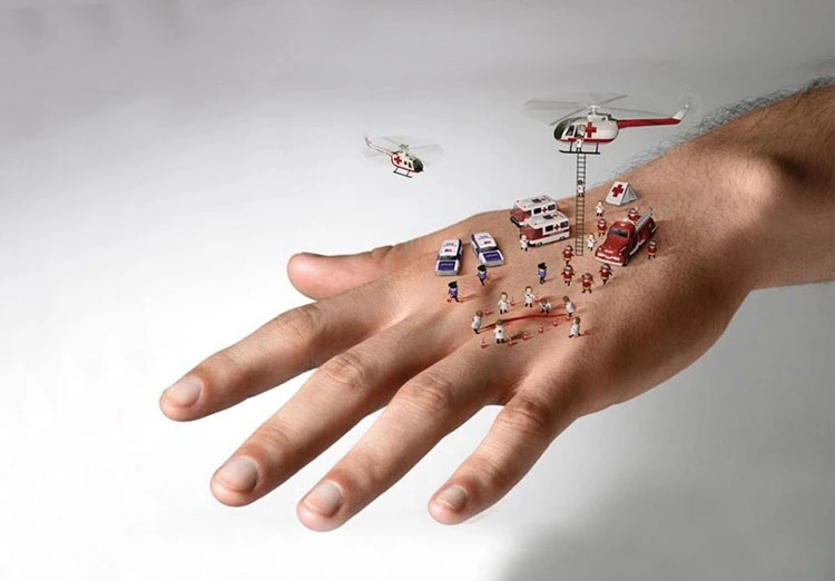 روش های خانگی درمان زخم ها روش های خانگی درمان زخم ها