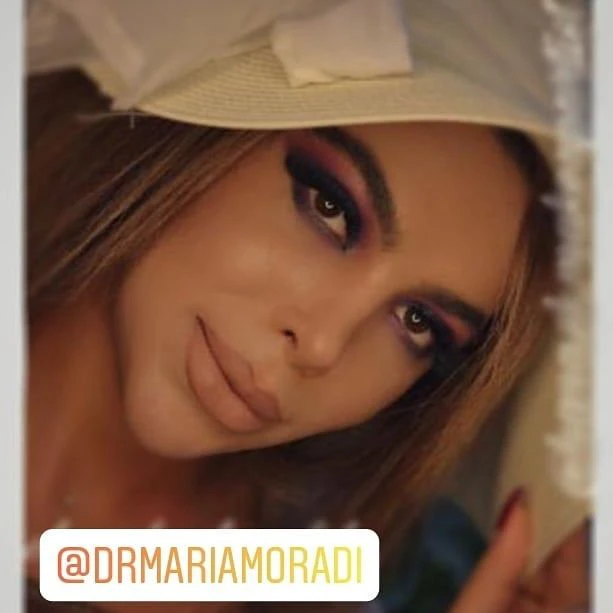 جراحی بینی استخوانی