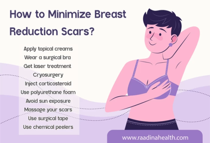 Breast reduction scars: Expectations and how to minimize them