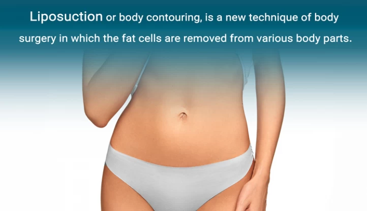 Liposuction-and-Body-Contouring 