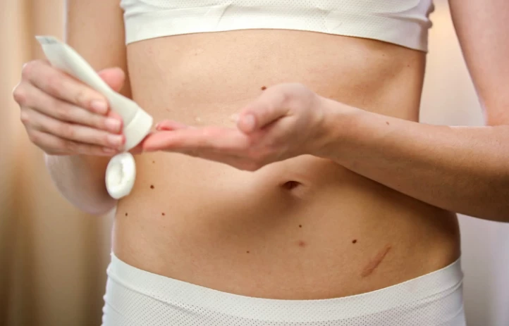 Say Goodbye to Lipo 360 Scars with CureIndia's Expert Care