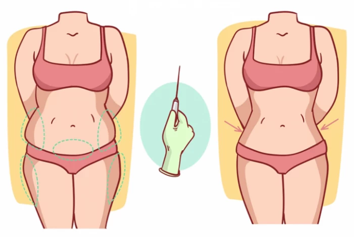 What Not to Do After Liposuction? + Foods to Avoid - Raadina Health