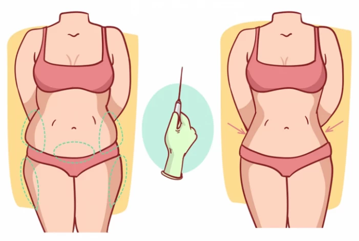 Liposuction After Care  What Not to do After Liposuction