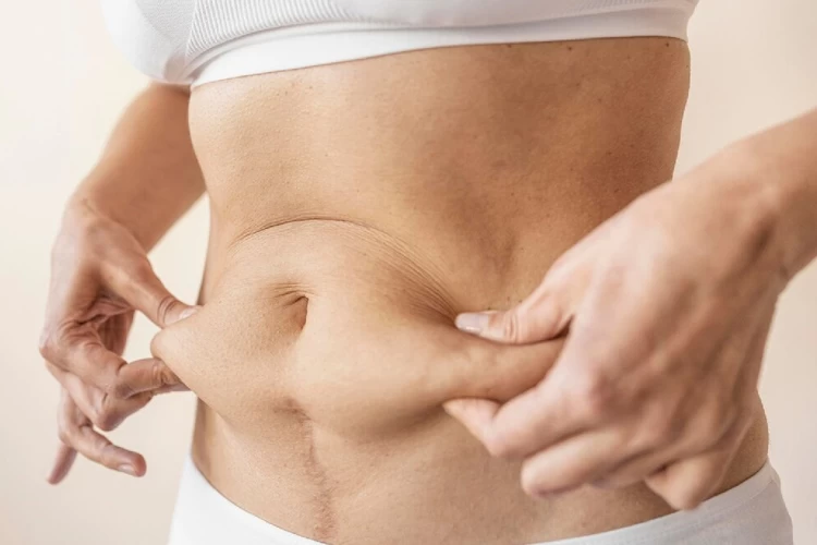 6 Signs of Bad Liposuction and How to Fix Them