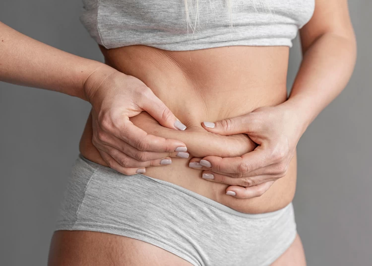Swelling After Liposuction: How Long and How to Reduce It - Synergy Wellness