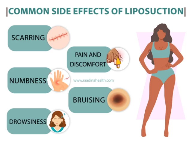 6 Signs of Bad Liposuction and How to Fix Them