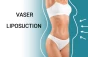 Everything About Vaser Lipouction Procedure