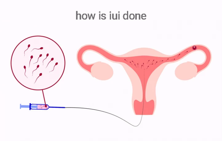 Insemination Pregnant Before After