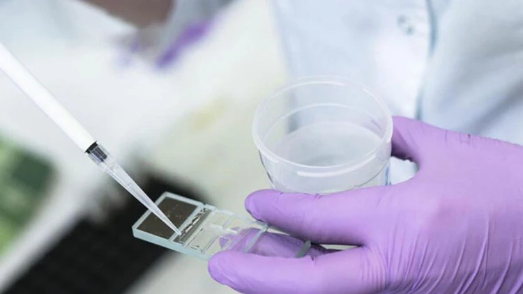Sperm Freezing for Future Use: Costs & Best Duration Sperm freezing can provide a solution for male infertility, offering the possibility of future parenthood.
