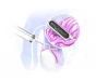 Testicular Biopsy