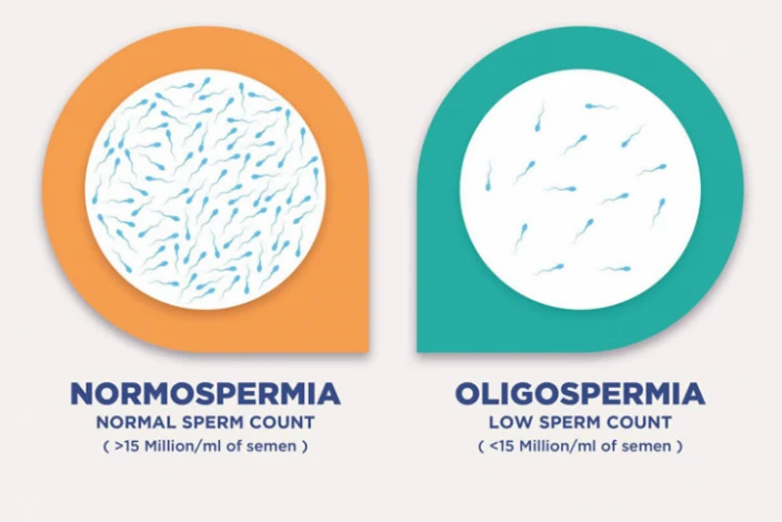 when is testicular biopsy needed Testicular biopsy is really helpful in azoospermia cases.