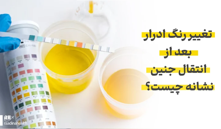 تغییر رنگ ادرار بعد از انتقال جنین نشانه چیست؟