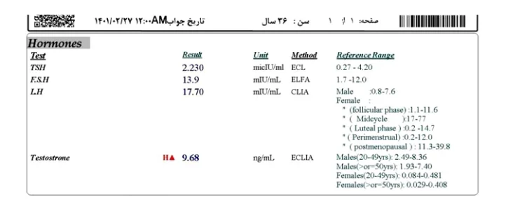 نتیجه آزمایش FSH
