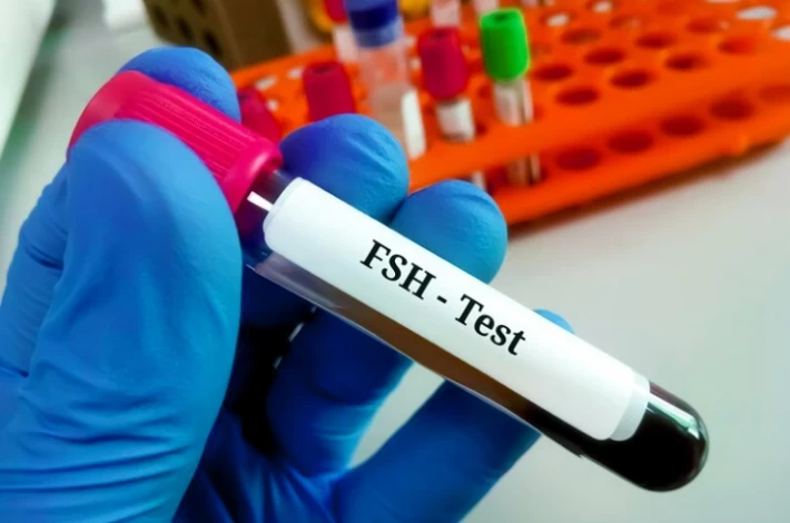 FSH چیست؟