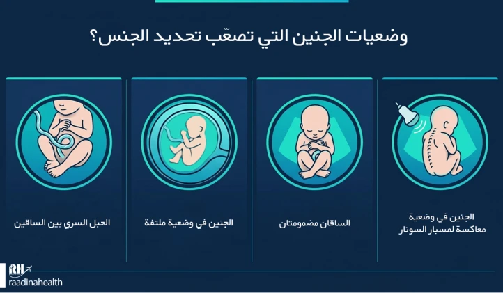 ما هي أوضاع الجنين التي تجعل من الصعب تحديد جنسه؟