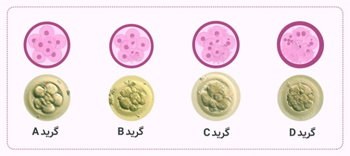 گرید جنین در ای وی اف سیستم درجه بندی جنین