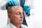 يقوم الجرّاح التجميلي في زراعة الشعر بتقنيّة اقلام تشوي DHI بإزالة بصيلات الشعر من المنطقة المانحة، ثمّ يزرعها في المنطقة المصابة بالصلع مستخدمًا آلة جراحيّة على شكل قلم.