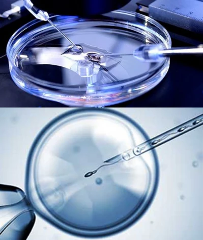fertilization in ICSI Injection is an important stage in icsi treatment.