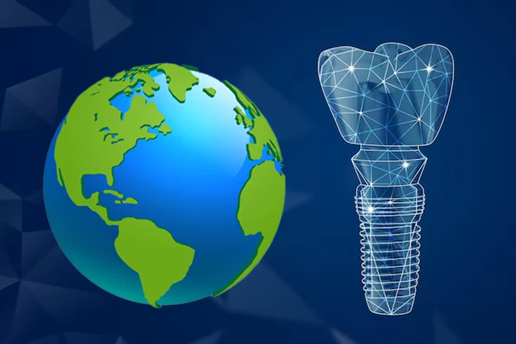 Top Destinations for Dental Implants Abroad: Which Country Is Better? Country for dental implant