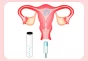 iui