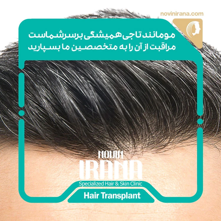 کلینیک کاشت مو