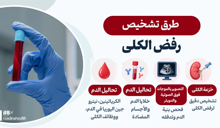 طرق تشخيص رفض الكلية