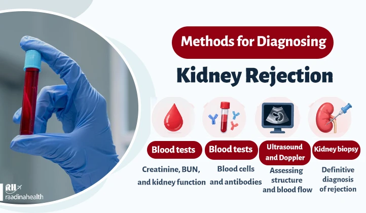 Diagnostic methods for kidney rejection