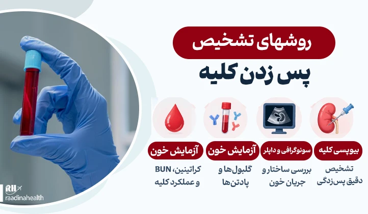 روش ‎های تشخیصی پس زدن کلیه