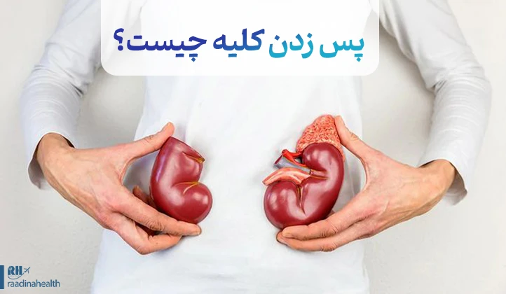 پس زدن کلیه چیست؟