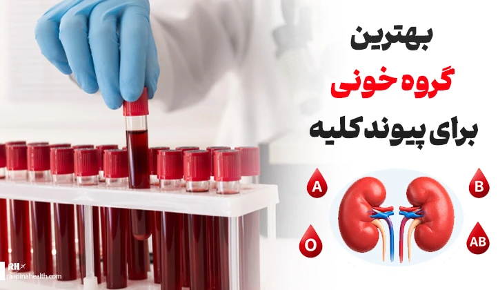 بهترین گروه خونی برای پیوند کلیه