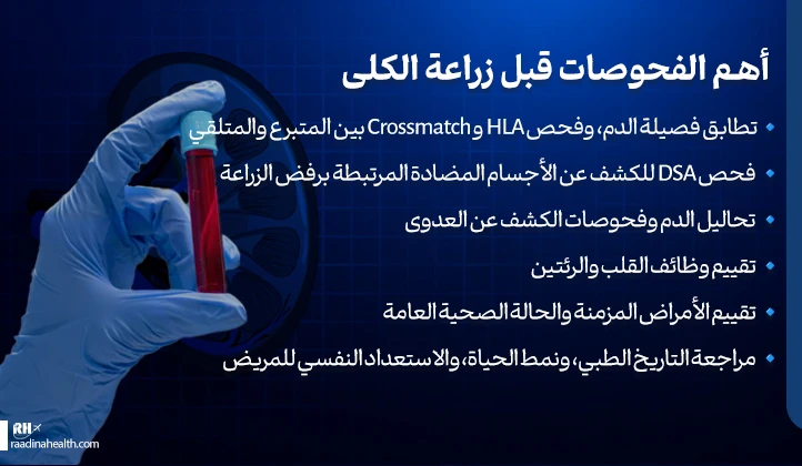 أهم الفحوصات قبل زراعة الكلى