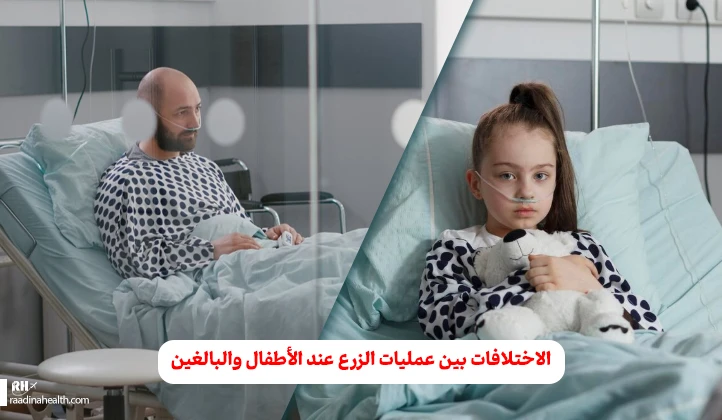 الاختلافات بين عمليات زراعة الكلى عند الأطفال والبالغين