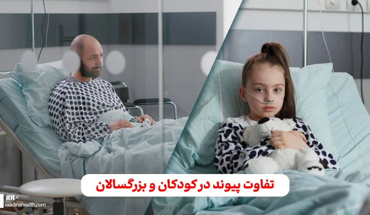 تفاوت پیوند در کودکان و بزرگسالان